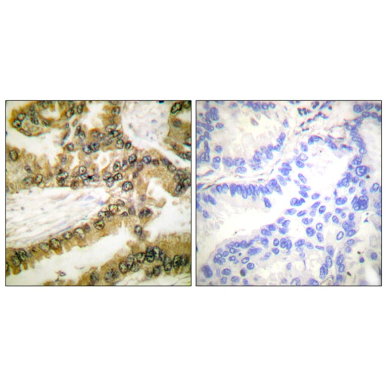 Immunohistochemistry - Anti-Akt1 (phospho Thr450) Antibody (A0406) - Antibodies.com