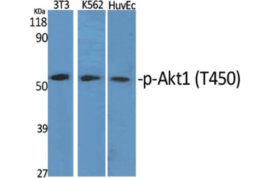 Western Blot - Anti-Akt1 (phospho Thr450) Antibody (A0406) - Antibodies.com