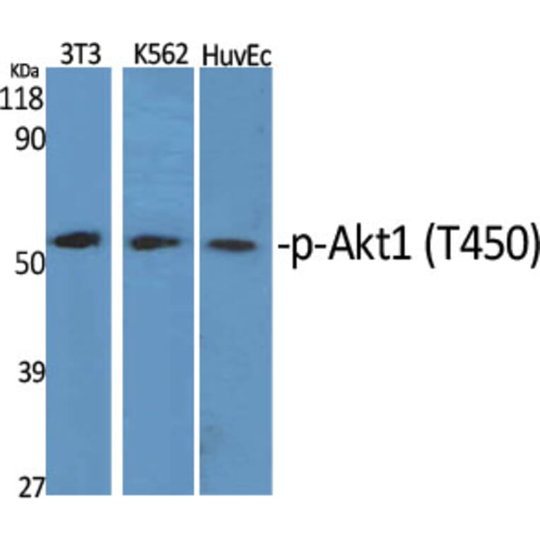 Western Blot - Anti-Akt1 (phospho Thr450) Antibody (A0406) - Antibodies.com