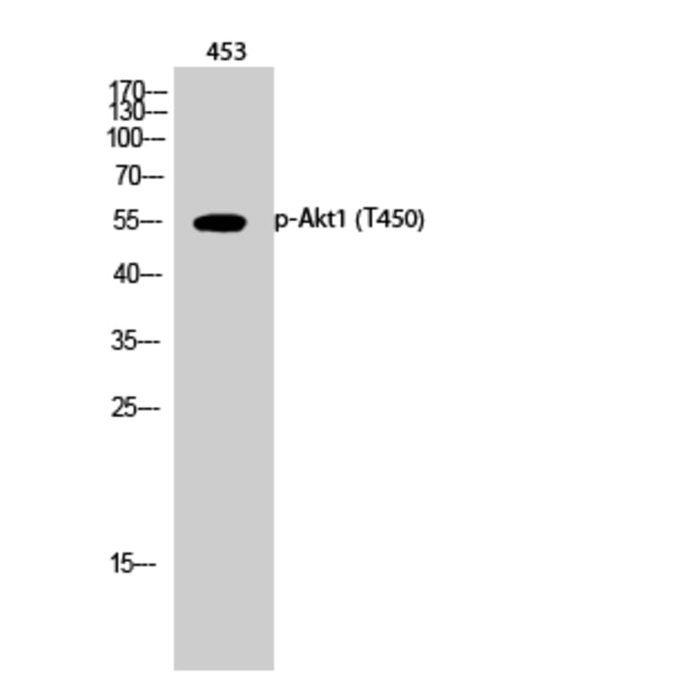 Western Blot - Anti-Akt1 (phospho Thr450) Antibody (A0406) - Antibodies.com