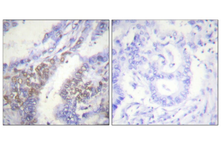 Immunohistochemistry - Anti-Akt1 (phospho Thr450) Antibody (A0406) - Antibodies.com