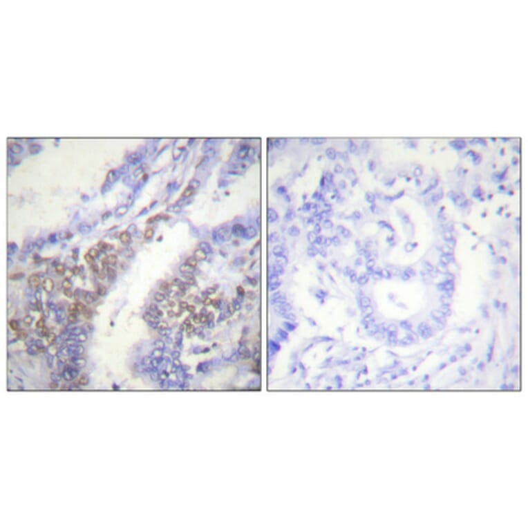 Immunohistochemistry - Anti-Akt1 (phospho Thr450) Antibody (A0406) - Antibodies.com
