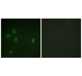 Immunofluorescence - Anti-53BP1 (phospho Ser25) Antibody (A0886) - Antibodies.com