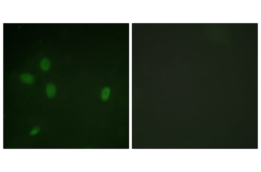 Immunofluorescence - Anti-53BP1 (phospho Ser25) Antibody (A0886) - Antibodies.com