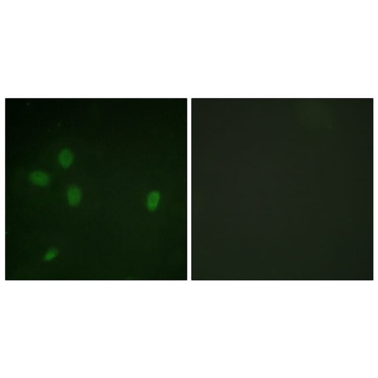 Immunofluorescence - Anti-53BP1 (phospho Ser25) Antibody (A0886) - Antibodies.com