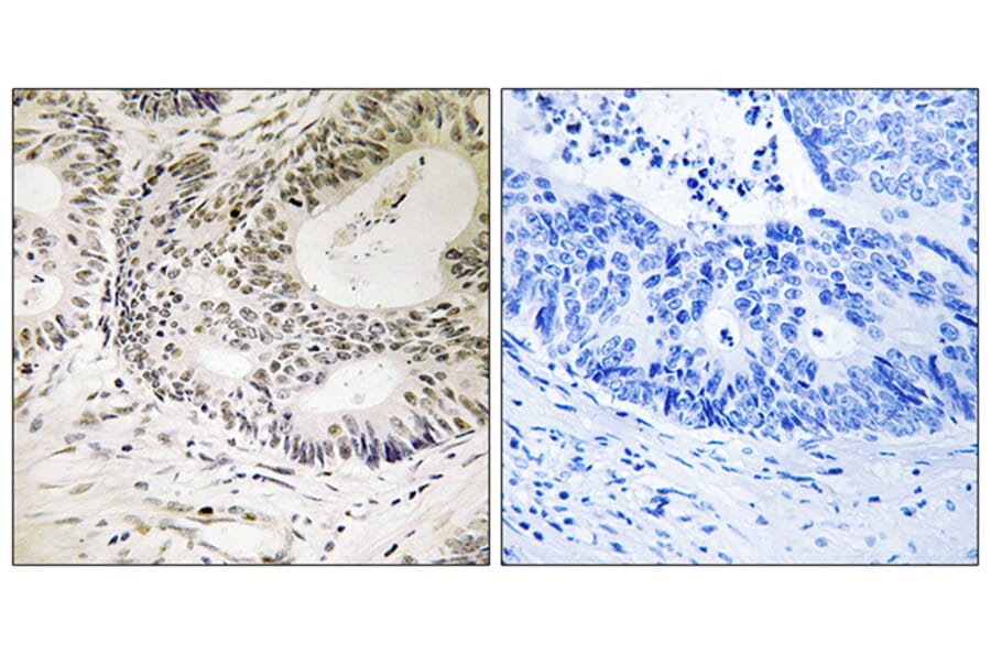 Immunohistochemistry - Anti-53BP1 (phospho Ser25) Antibody (A0886) - Antibodies.com