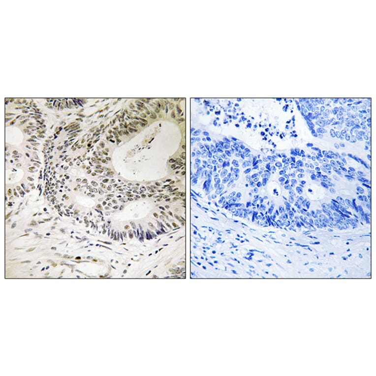 Immunohistochemistry - Anti-53BP1 (phospho Ser25) Antibody (A0886) - Antibodies.com