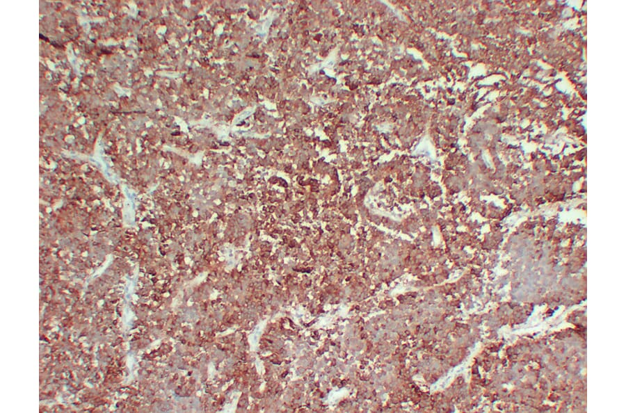 Immunohistochemistry - Anti-Follicle Stimulating Hormone Antibody (V0073) - Antibodies.com
