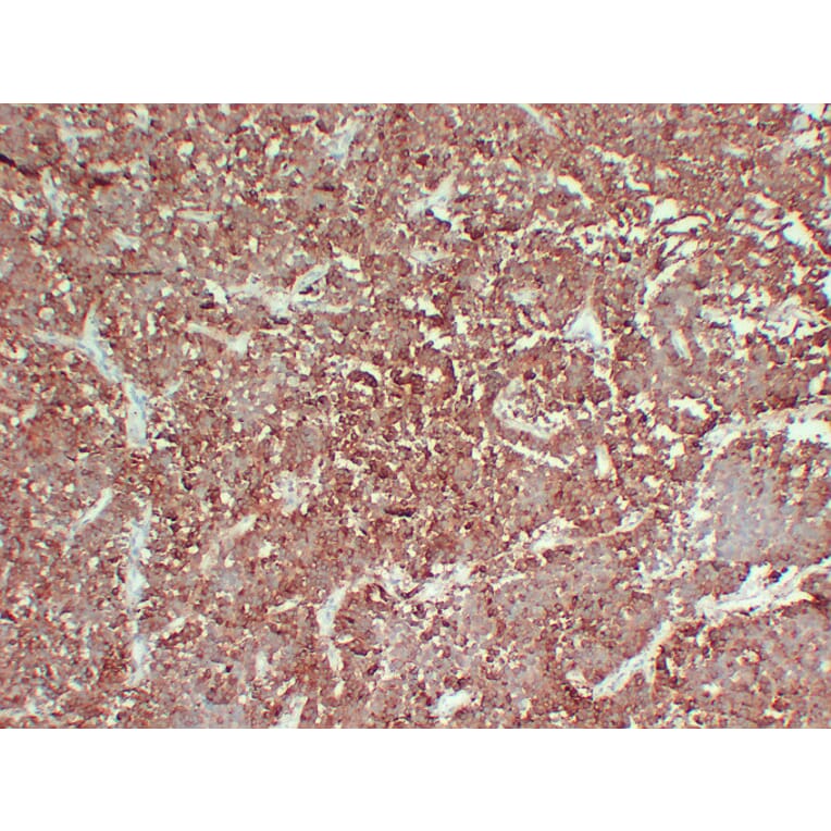 Immunohistochemistry - Anti-Follicle Stimulating Hormone Antibody (V0073) - Antibodies.com