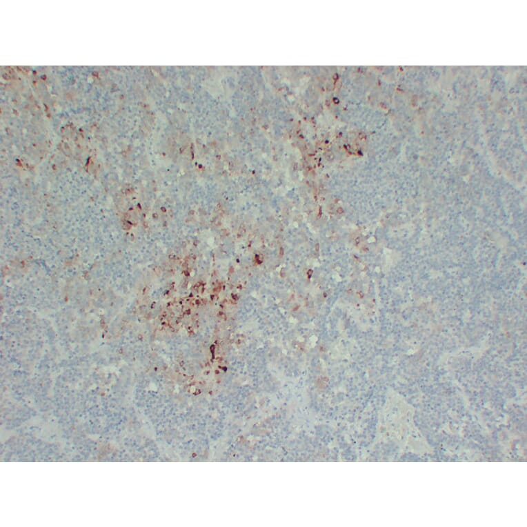 Immunohistochemistry - Anti-Follicle Stimulating Hormone Antibody (V0073) - Antibodies.com