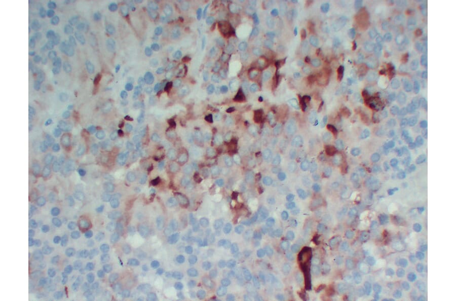 Immunohistochemistry - Anti-Follicle Stimulating Hormone Antibody (V0073) - Antibodies.com