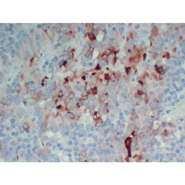 Immunohistochemistry - Anti-Follicle Stimulating Hormone Antibody (V0073) - Antibodies.com