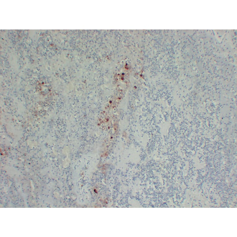 Immunohistochemistry - Anti-Follicle Stimulating Hormone Antibody (V0073) - Antibodies.com