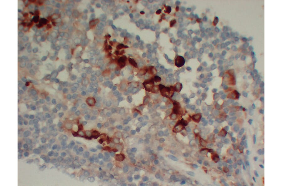 Immunohistochemistry - Anti-Follicle Stimulating Hormone Antibody (V0073) - Antibodies.com