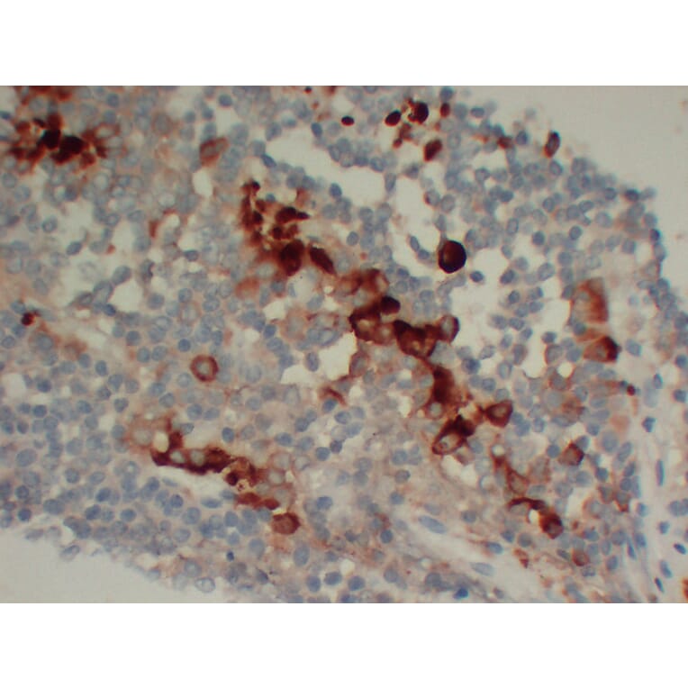 Immunohistochemistry - Anti-Follicle Stimulating Hormone Antibody (V0073) - Antibodies.com