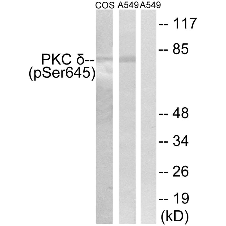 Western Blot - Anti-PKC delta (phospho Ser645) Antibody (A7196) - Antibodies.com