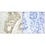 Immunohistochemistry - Anti-PKC delta (phospho Ser645) Antibody (A7196) - Antibodies.com