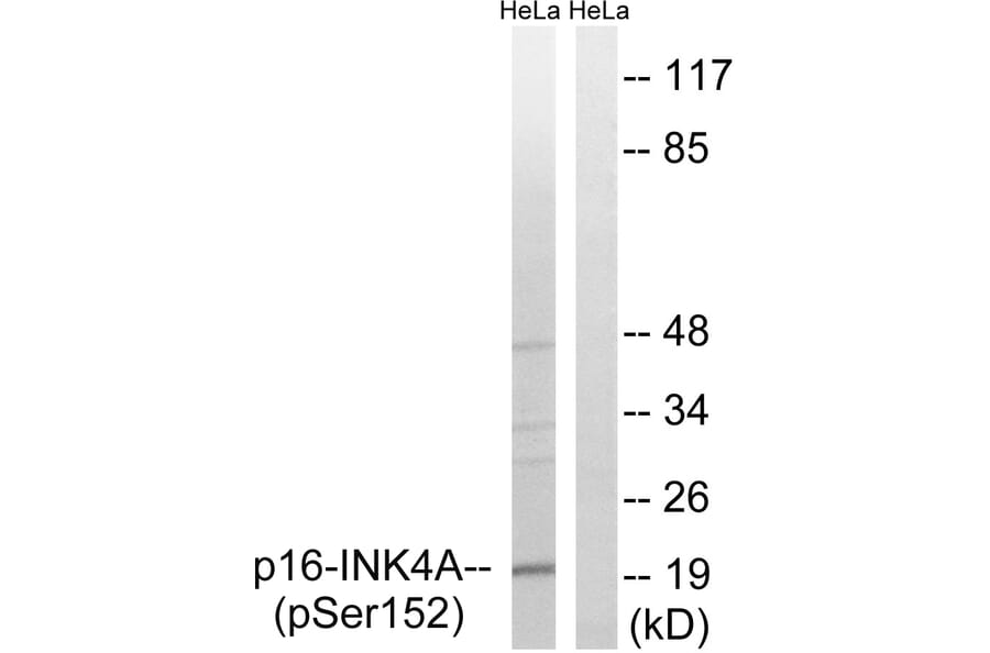 Western Blot - Anti-p16-INK4a (phospho Ser152) Antibody (A8389) - Antibodies.com