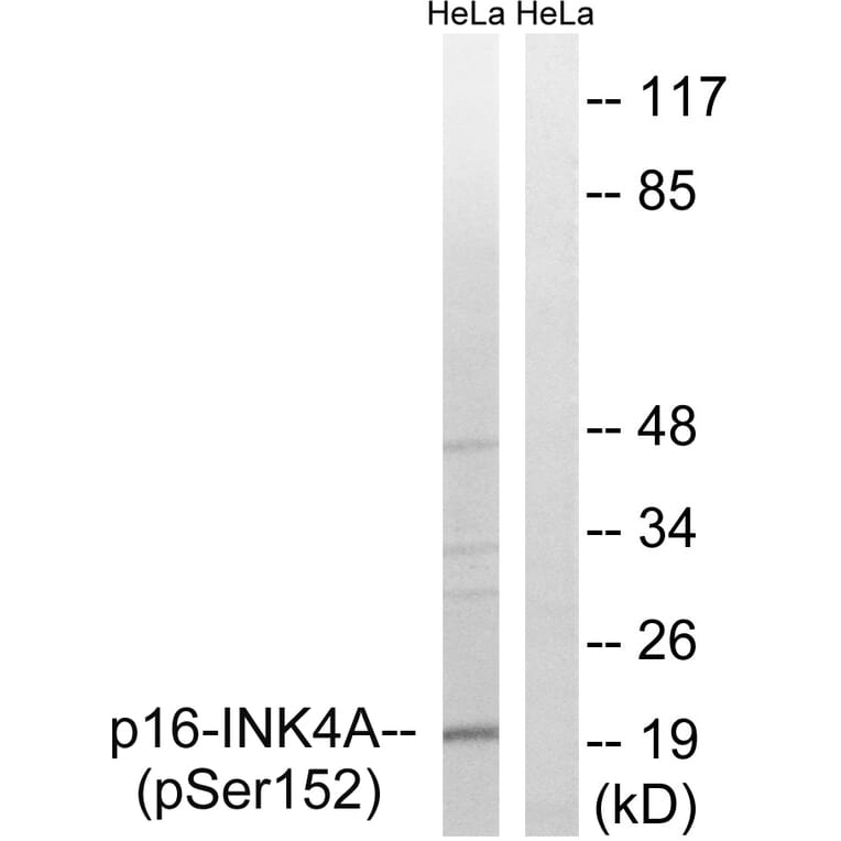 Western Blot - Anti-p16-INK4a (phospho Ser152) Antibody (A8389) - Antibodies.com