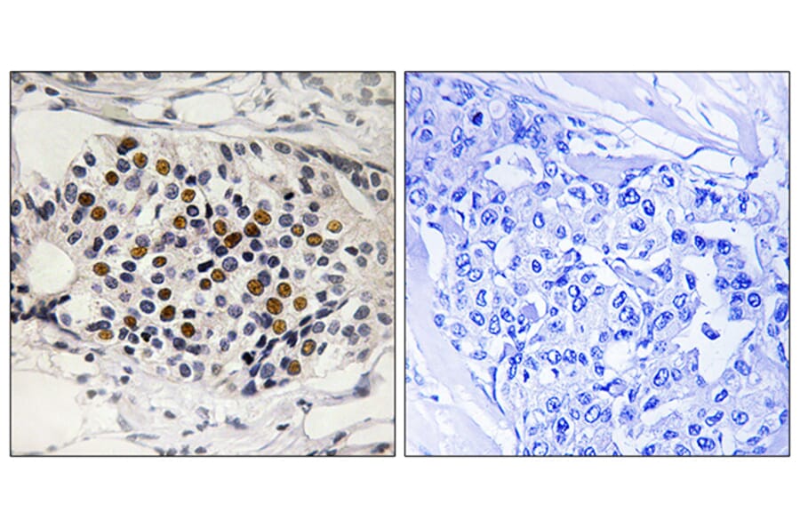 Immunohistochemistry - Anti-p16-INK4a (phospho Ser152) Antibody (A8389) - Antibodies.com