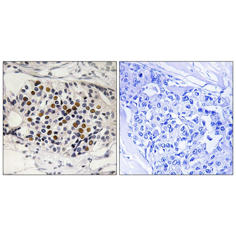 Immunohistochemistry - Anti-p16-INK4a (phospho Ser152) Antibody (A8389) - Antibodies.com