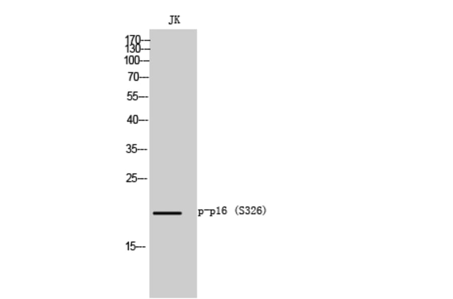 Western Blot - Anti-p16-INK4a (phospho Ser152) Antibody (A8389) - Antibodies.com