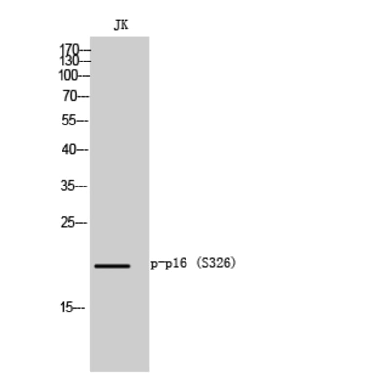 Western Blot - Anti-p16-INK4a (phospho Ser152) Antibody (A8389) - Antibodies.com