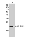 Western Blot - Anti-p16-INK4a (phospho Ser152) Antibody (A8389) - Antibodies.com
