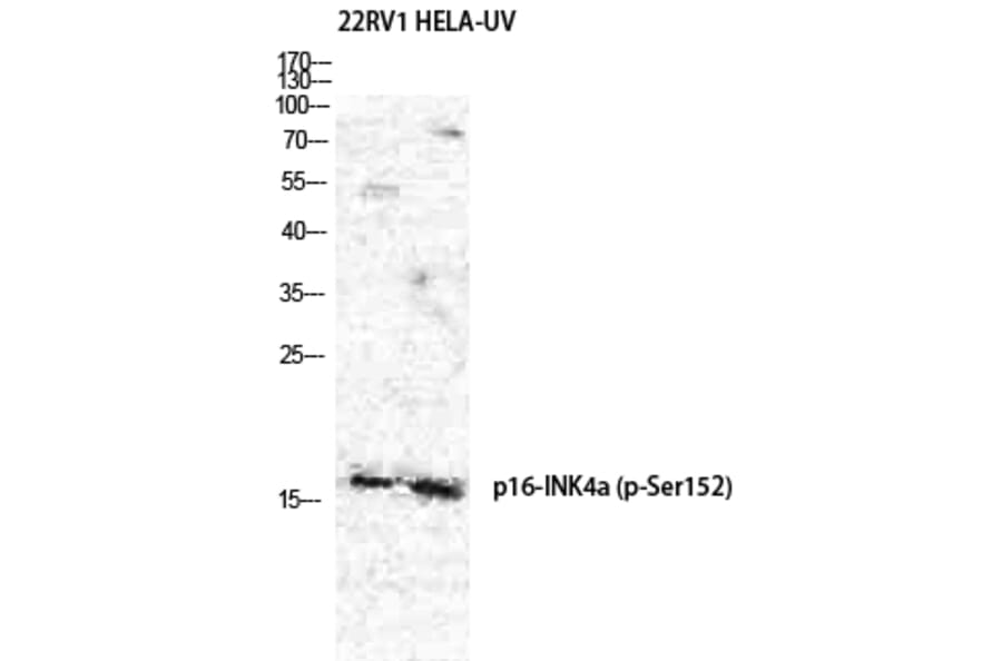 Western Blot - Anti-p16-INK4a (phospho Ser152) Antibody (A8389) - Antibodies.com