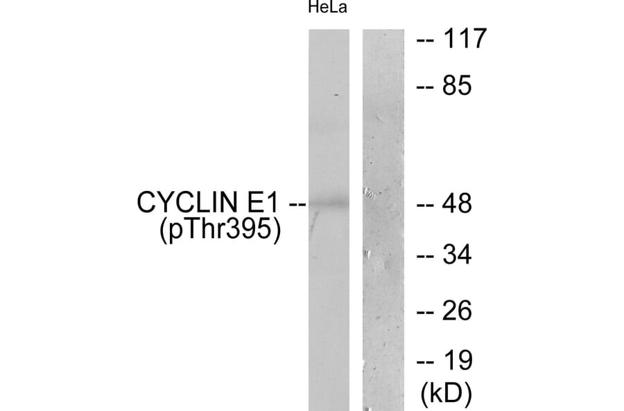 Western Blot - Anti-Cyclin E1 (phospho Thr395) Antibody (A0069) - Antibodies.com