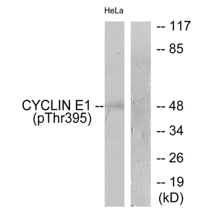 Western Blot - Anti-Cyclin E1 (phospho Thr395) Antibody (A0069) - Antibodies.com