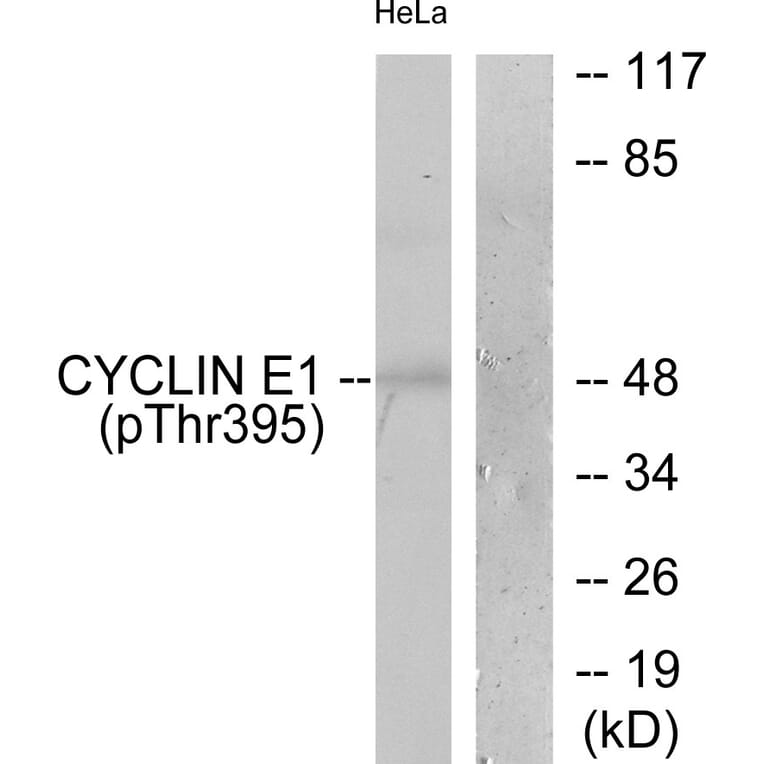 Western Blot - Anti-Cyclin E1 (phospho Thr395) Antibody (A0069) - Antibodies.com