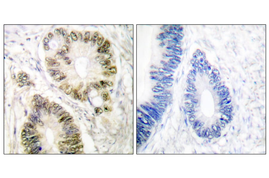 Immunohistochemistry - Anti-Cyclin E1 (phospho Thr395) Antibody (A0069) - Antibodies.com