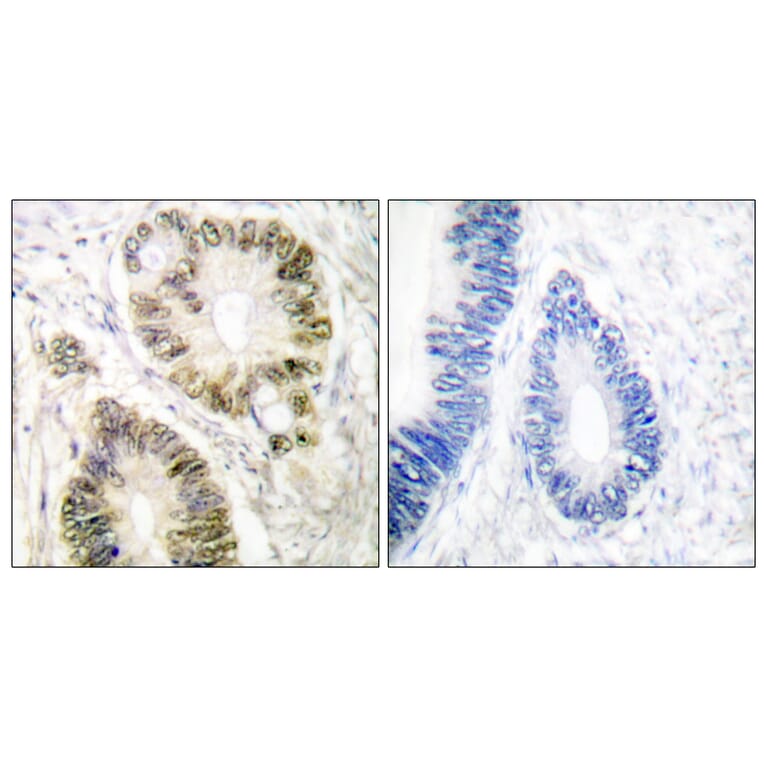 Immunohistochemistry - Anti-Cyclin E1 (phospho Thr395) Antibody (A0069) - Antibodies.com