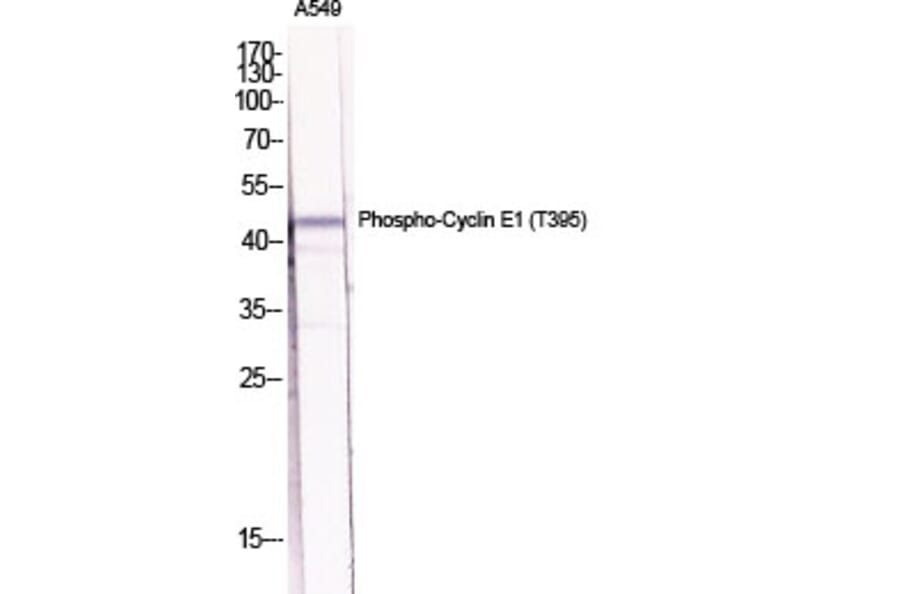Western Blot - Anti-Cyclin E1 (phospho Thr395) Antibody (A0069) - Antibodies.com
