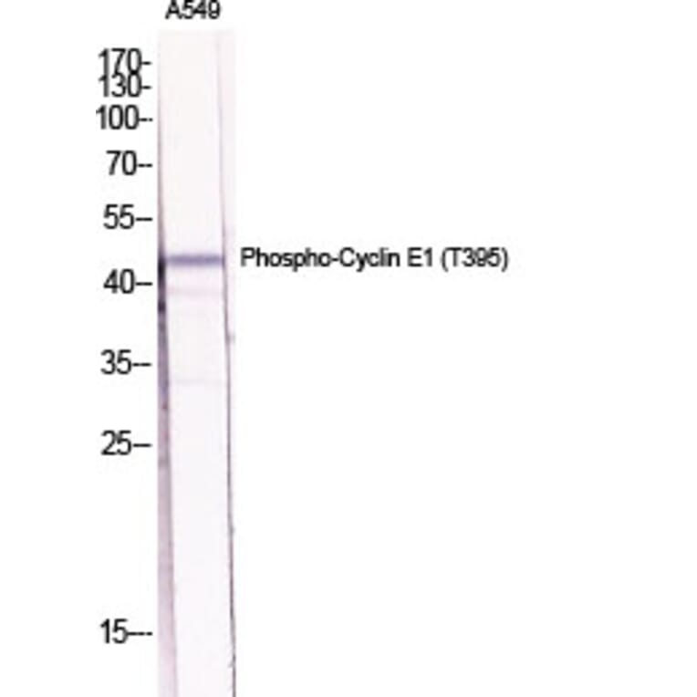 Western Blot - Anti-Cyclin E1 (phospho Thr395) Antibody (A0069) - Antibodies.com