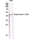 Western Blot - Anti-Cyclin E1 (phospho Thr395) Antibody (A0069) - Antibodies.com