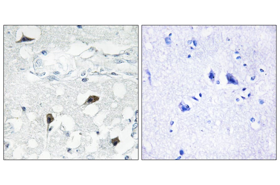 Immunohistochemistry - Anti-Caspase 3 (cleaved Asp175) Antibody (L0105) - Antibodies.com