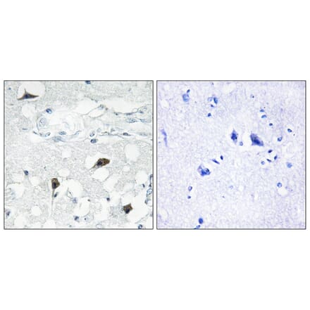 Immunohistochemistry - Anti-Caspase 3 (cleaved Asp175) Antibody (L0105) - Antibodies.com