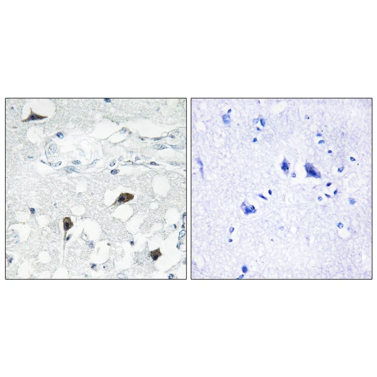Immunohistochemistry - Anti-Caspase 3 (cleaved Asp175) Antibody (L0105) - Antibodies.com