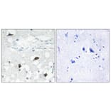 Immunohistochemistry - Anti-Caspase 3 (cleaved Asp175) Antibody (L0105) - Antibodies.com