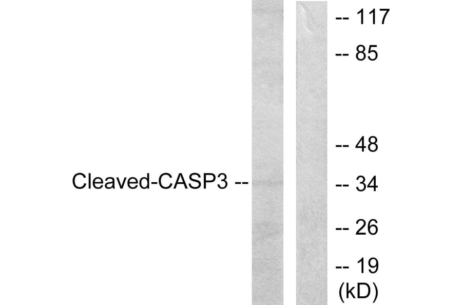 Western Blot - Anti-Caspase 3 (cleaved Asp175) Antibody (L0105) - Antibodies.com