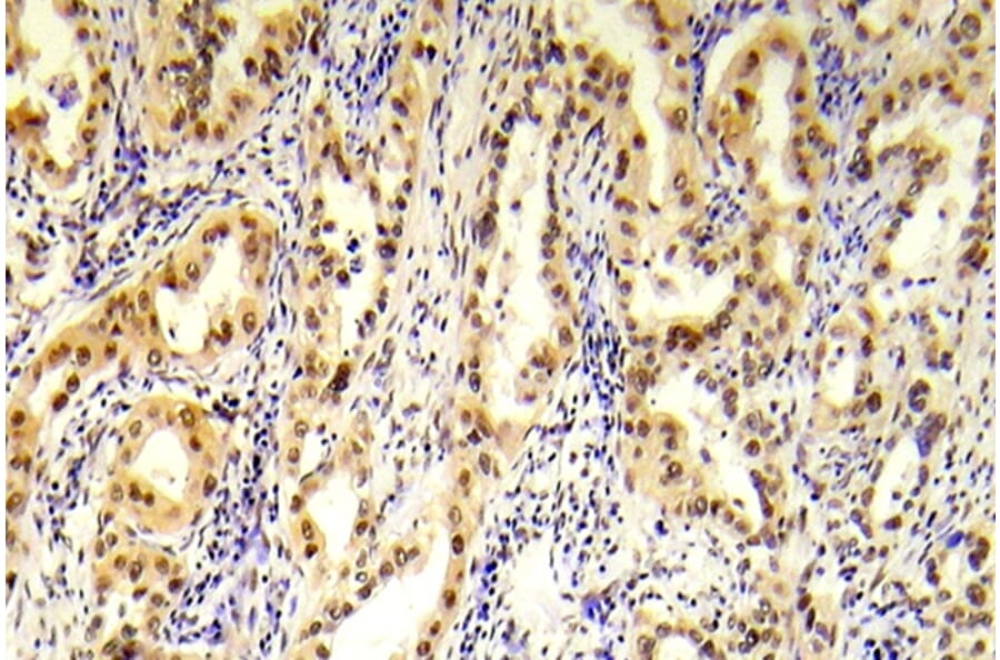 Immunohistochemistry - Anti-Tuberin (phospho Ser1254) Antibody (P12-1063) - Antibodies.com