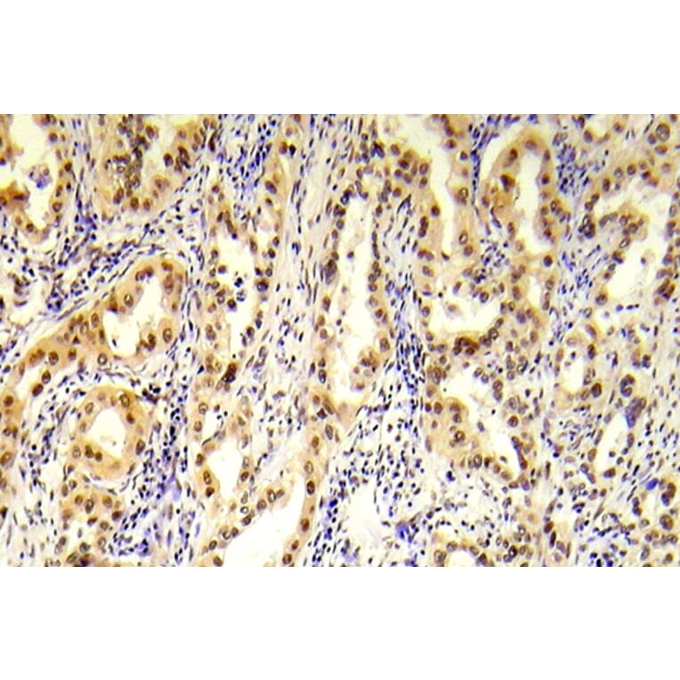 Immunohistochemistry - Anti-Tuberin (phospho Ser1254) Antibody (P12-1063) - Antibodies.com