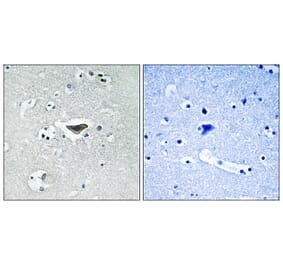 Immunohistochemistry - Anti-Ras-GRF1 (phospho Ser916) Antibody (A0728) - Antibodies.com