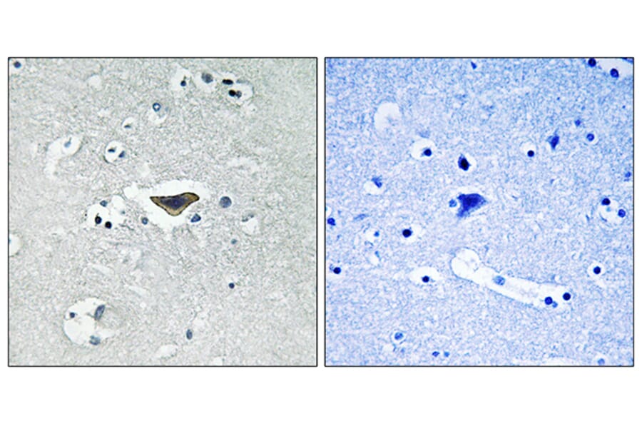 Immunohistochemistry - Anti-Ras-GRF1 (phospho Ser916) Antibody (A0728) - Antibodies.com