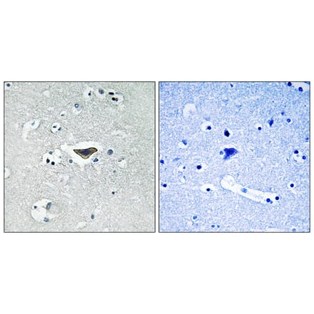 Immunohistochemistry - Anti-Ras-GRF1 (phospho Ser916) Antibody (A0728) - Antibodies.com