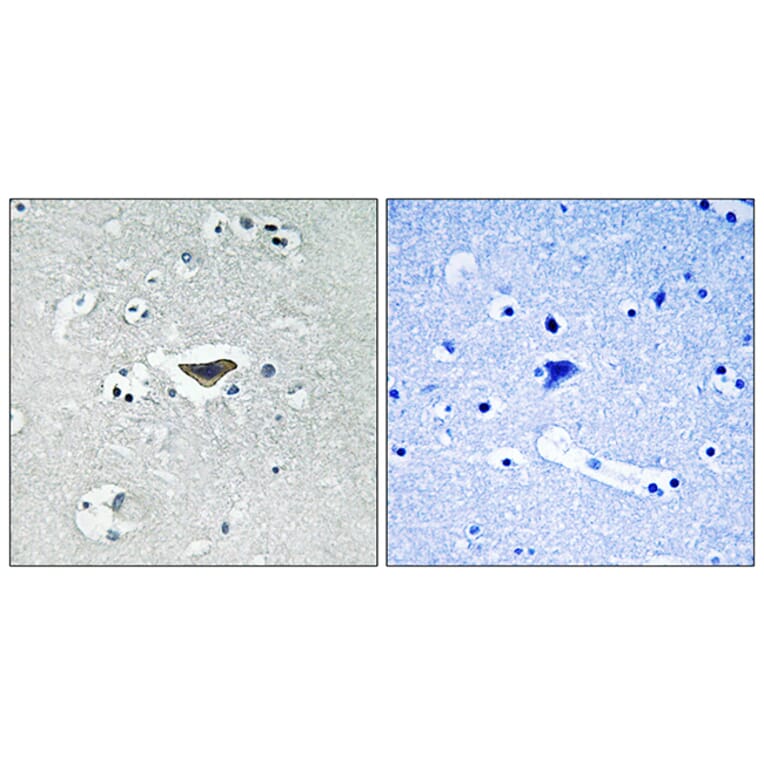 Immunohistochemistry - Anti-Ras-GRF1 (phospho Ser916) Antibody (A0728) - Antibodies.com