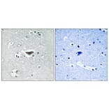 Immunohistochemistry - Anti-Ras-GRF1 (phospho Ser916) Antibody (A0728) - Antibodies.com