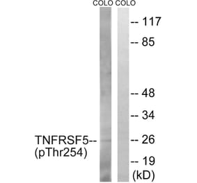Western Blot - Anti-TNFRSF5 (phospho Thr254) Antibody (A1129) - Antibodies.com